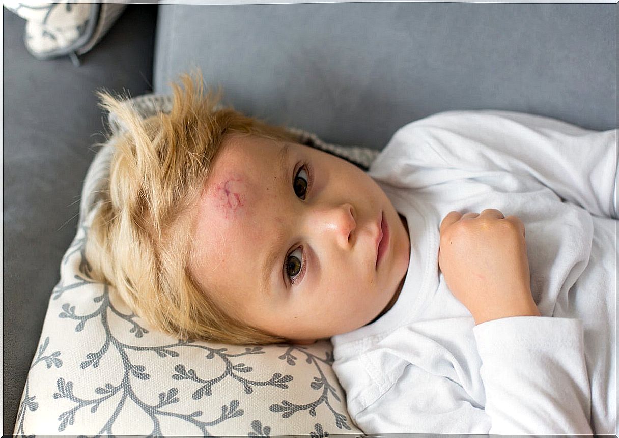 10 tricks to cure bumps in children