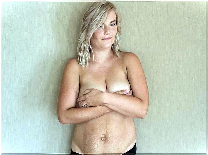 A mother shows her body after giving birth in defense of the beauty of the female body