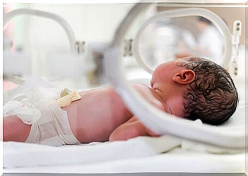 Questions and Answers About Premature Babies