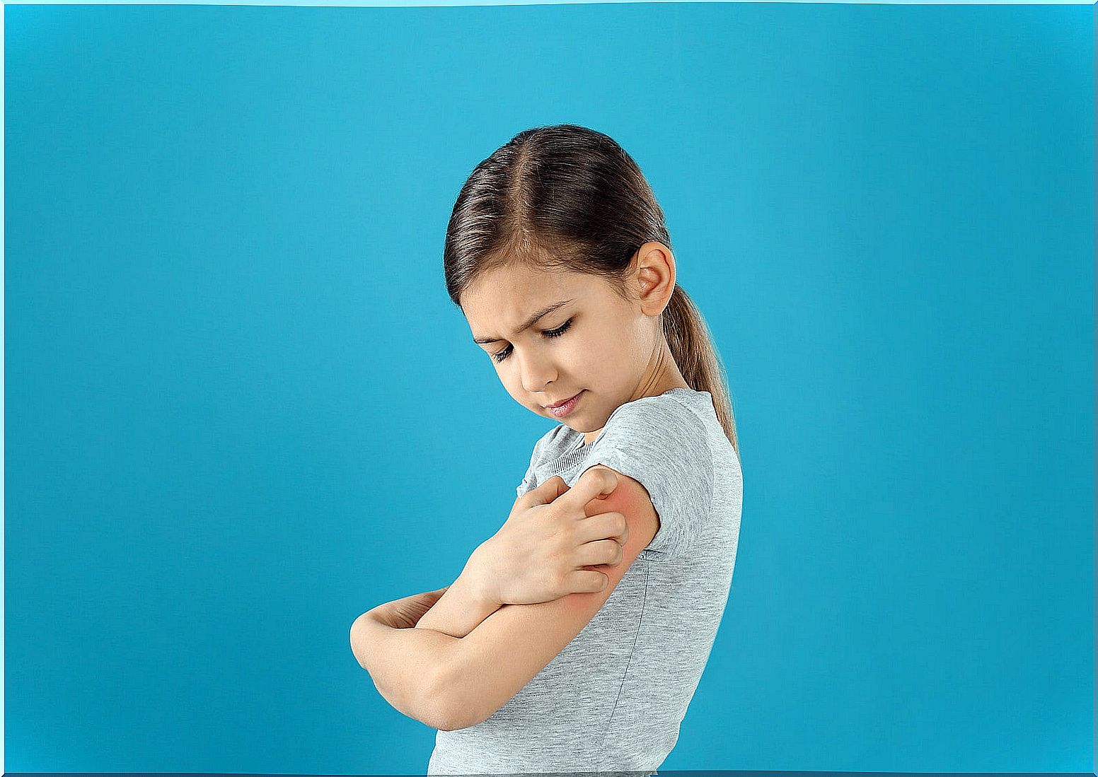 Girl scratching her arm because she has dry skin.