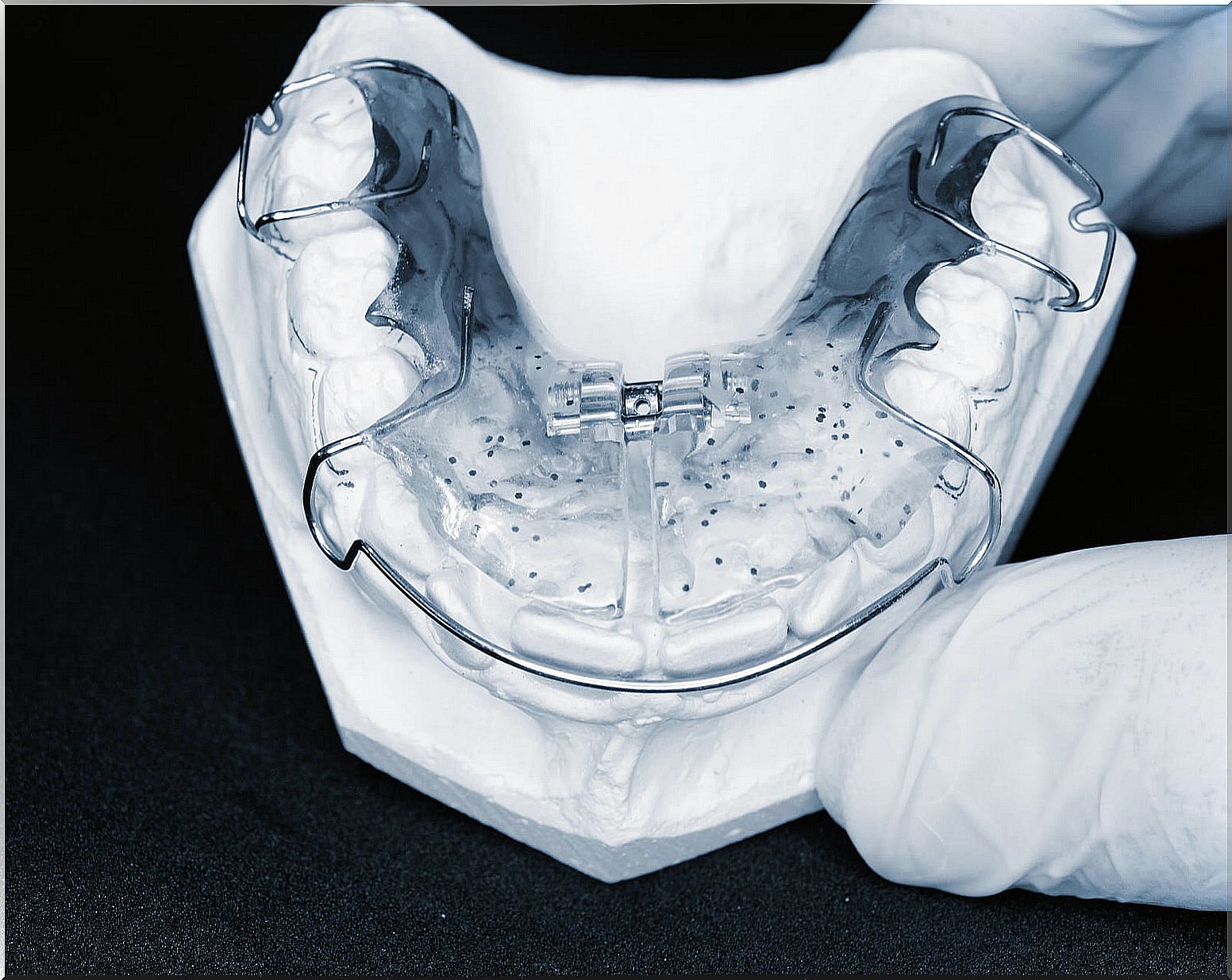 Interceptive orthodontics.