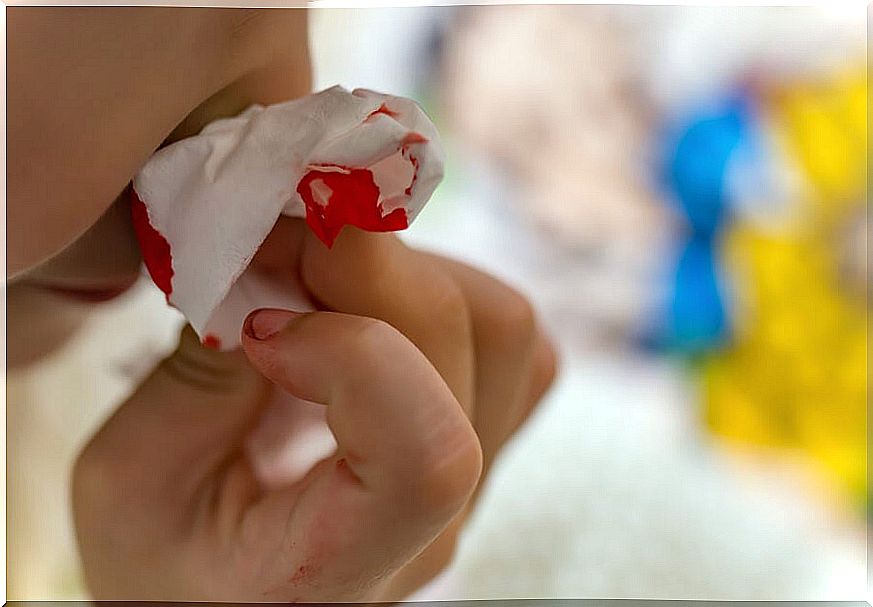 My son's nose bleeds a lot.  What should I do?