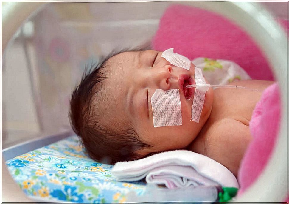 Newborn premature baby with respiratory distress syndrome.