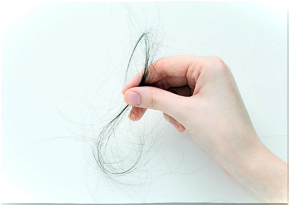 Lock of hair pulled out due to trichotillomania.